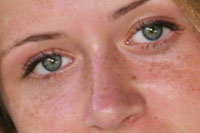 Remove Freckles Photoshop Tutorial